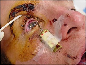 Click image for larger version

Name:	fishhook_eye.jpg
Views:	549
Size:	40.9 KB
ID:	3079
