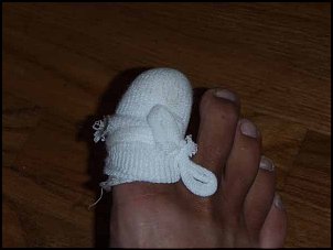 Click image for larger version

Name:	Bandaged Toe.jpg
Views:	517
Size:	27.1 KB
ID:	2691