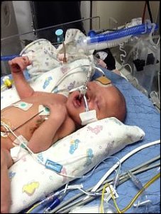 Click image for larger version

Name:	Easton with oxygen tube.jpg
Views:	594
Size:	19.3 KB
ID:	7187